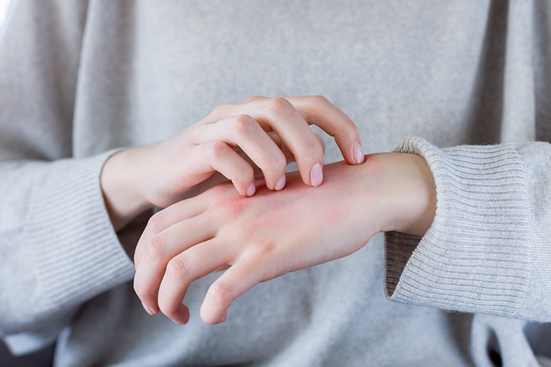 Girl scratching her hand, which has red, inflamed skin from her work activities