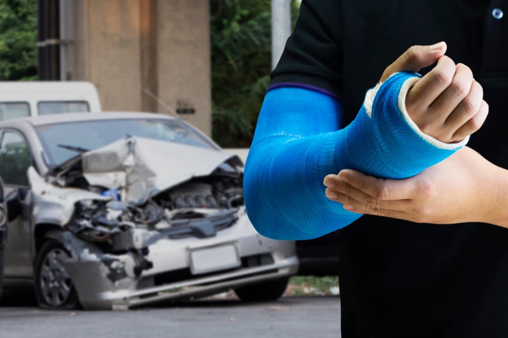 What Are Common Injuries Resulting from Car Accidents