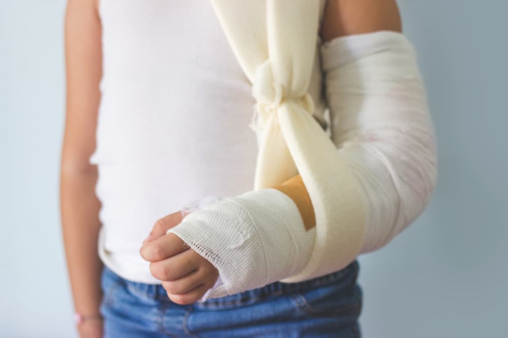 child with cast for broken arm