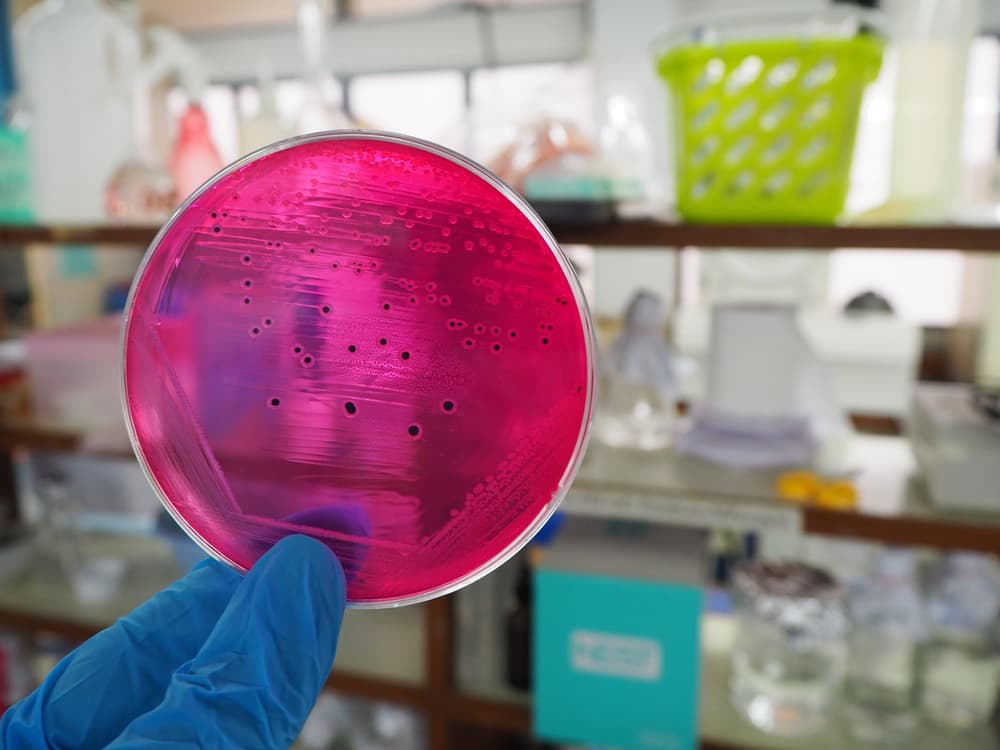 A scientist holds an agar plate displaying distinct black colonies of salmonella, highlighting bacterial growth in a controlled environment.